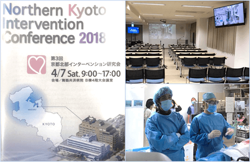 急性・慢性心不全診療ガイドライン2017版より抜粋